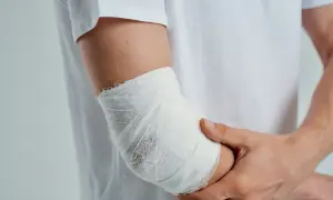 Kiedy zacząć rehabilitację po złamaniu kości ramiennej? Pełny poradnik