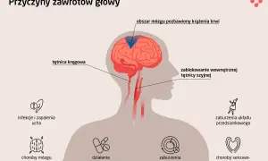 Ilustracja pokazuje przyczyny zawrotów głowy, m.in. problemy z krążeniem mózgu, infekcje ucha, choroby mózgu, zaburzenia metaboliczne i sercowo-naczyniowe.