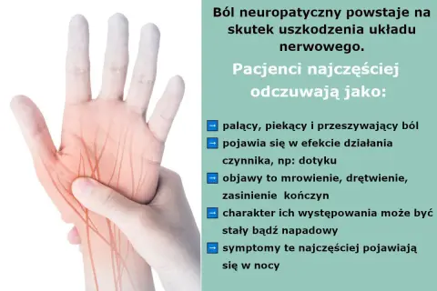 Dłoń z zaznaczonymi nerwami, symbolizująca ból neuropatyczny. Informacje o objawach i leczeniu leki na nerwy obwodowe.