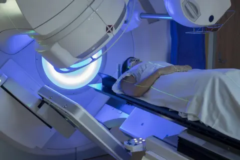 Pacjentka leży pod aparatem do radioterapii. Trudno ocenić, co gorsze chemioterapia czy radioterapia, ale obie metody leczenia raka są wyzwaniem.
