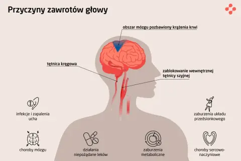 Ilustracja pokazuje przyczyny zawrotów głowy, m.in. problemy z krążeniem mózgu, infekcje ucha, choroby mózgu, zaburzenia metaboliczne i sercowo-naczyniowe.