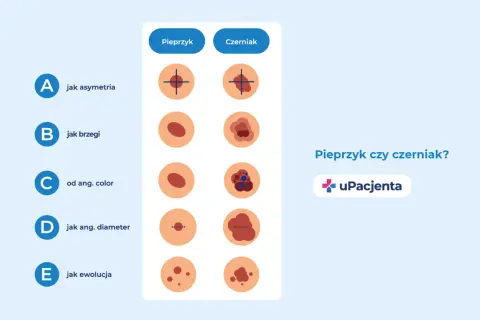 Porównanie znamion: pieprzyk vs czerniak. Wczesne wykrycie czerniaka jest kluczowe, bo czy czerniak jest uleczalny? Tak, wcześnie wykryty.