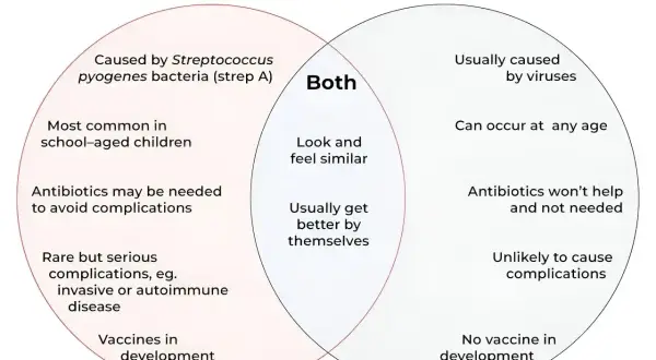 Ból gardła spowodowany wirusami nie wymaga antybiotyków. Diagram porównuje anginę bakteryjną i wirusowe zapalenie gardła.