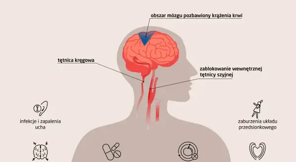 Ilustracja pokazuje przyczyny zawrotów głowy, m.in. problemy z krążeniem mózgu, infekcje ucha, choroby mózgu, zaburzenia metaboliczne i sercowo-naczyniowe.