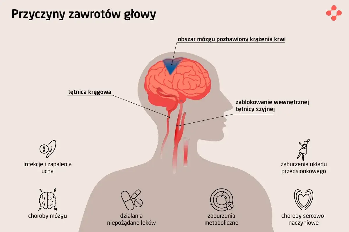 Ilustracja pokazuje przyczyny zawrotów głowy, m.in. problemy z krążeniem mózgu, infekcje ucha, choroby mózgu, zaburzenia metaboliczne i sercowo-naczyniowe.