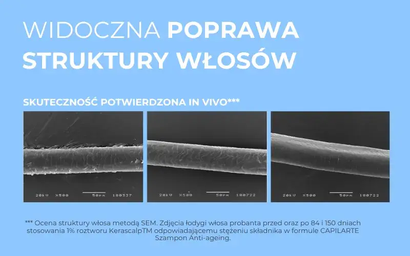 starzenie się włos&oacute;w mikroskop