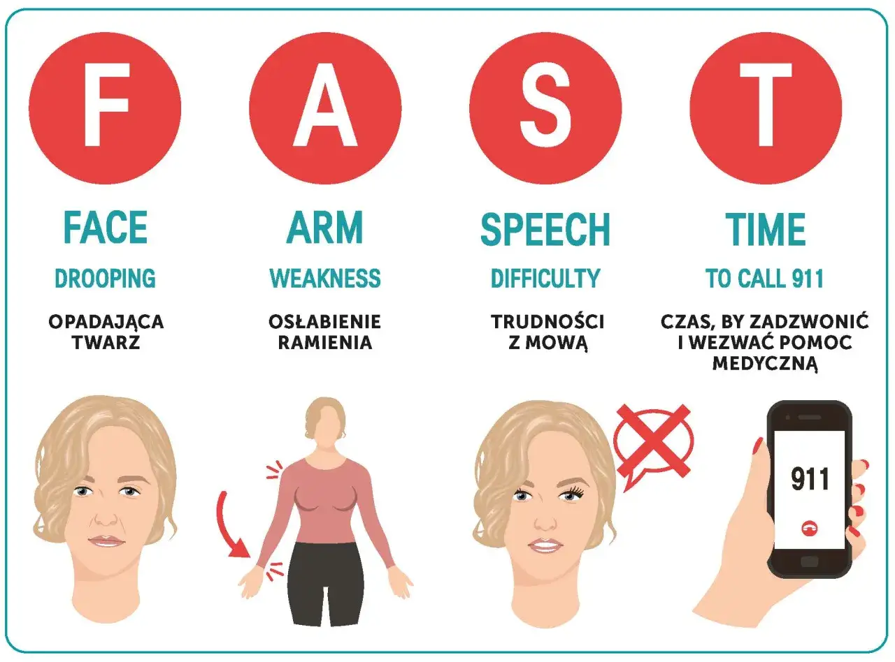 Test FAST udar mózgu infografika