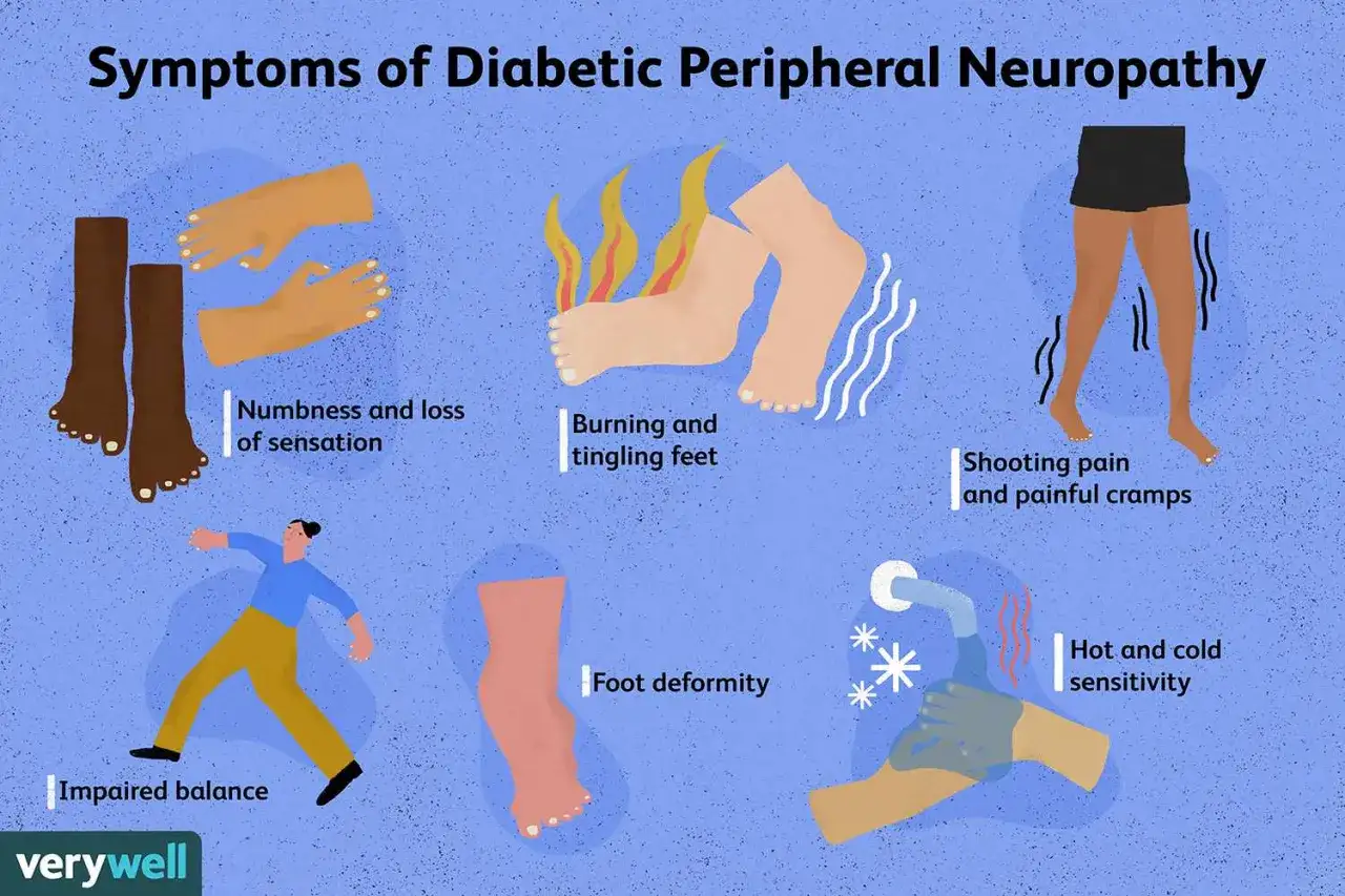 Objawy neuropatii cukrzycowej: drętwienie, pieczenie, skurcze, zaburzenia równowagi, deformacje stóp, wrażliwość na temperaturę.