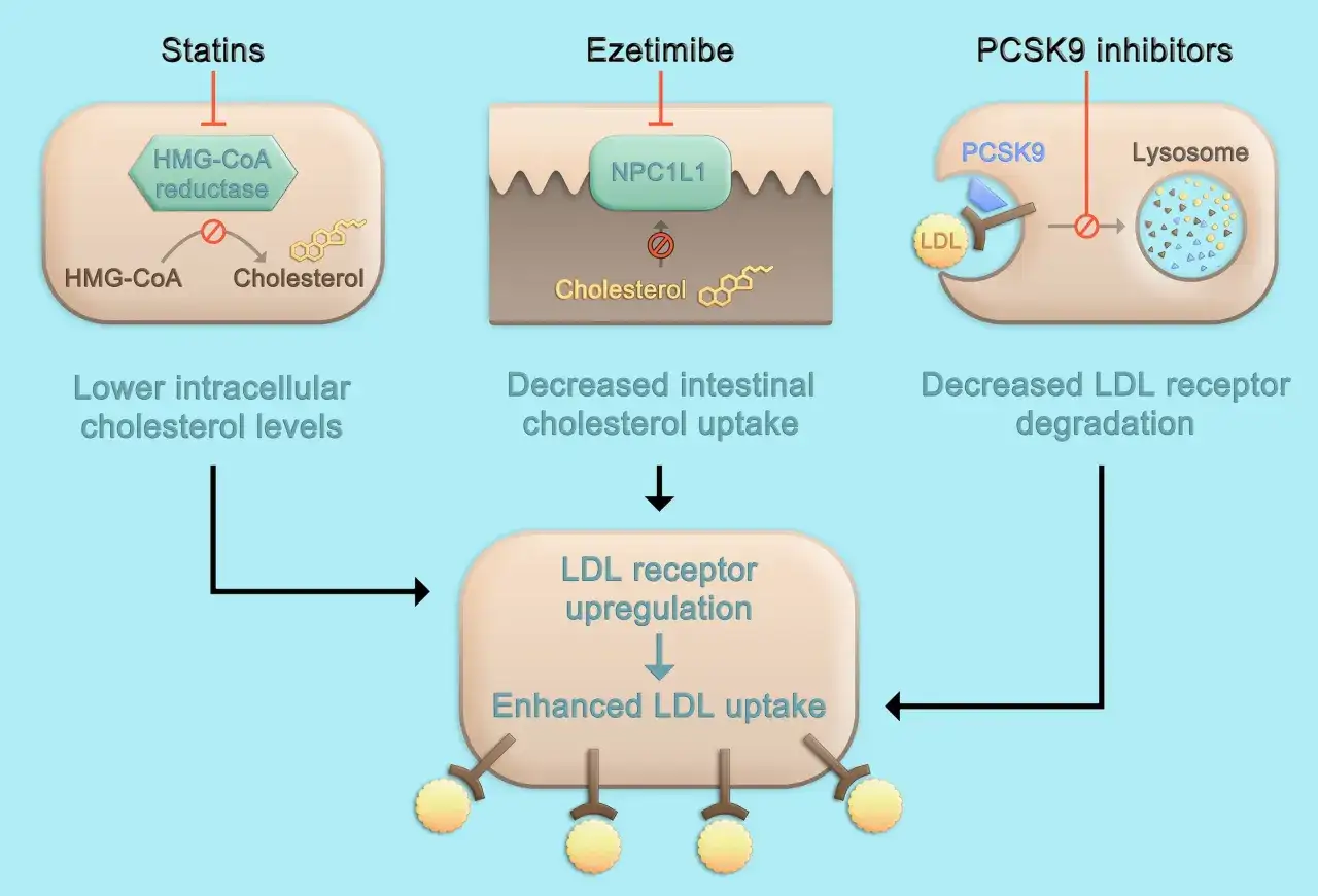 Schemat przedstawia mechanizmy działania statyn, ezetymibu i inhibitorów PCSK9, które pomagają obniżyć cholesterol. To najmniej szkodliwy lek na cholesterol.
