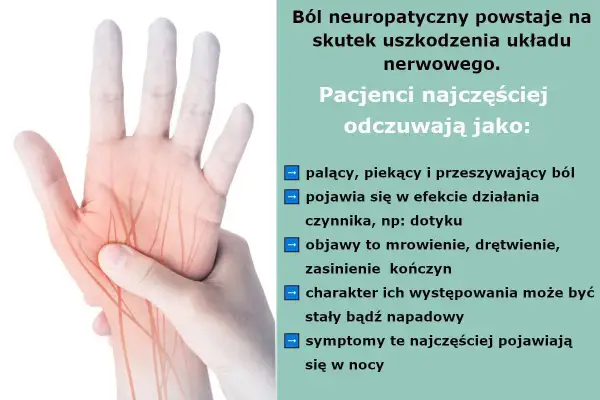 Dłoń z zaznaczonymi nerwami, symbolizująca ból neuropatyczny. Informacje o objawach i leczeniu leki na nerwy obwodowe.